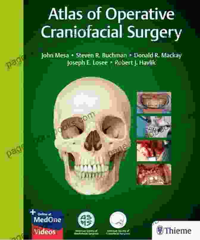 Craniofacial Surgery Board Review Book Cover Craniofacial Surgery Board Review (Board Review In Craniofacial Surgery 1)