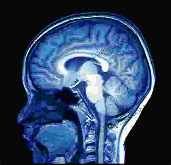 High Resolution MRI Scan Of White Matter Pathways In The Human Brain, Showcasing The Intricate Connections And Detailed Segmentation From The Tesla MRI Brain White Matter Atlas 7 0 Tesla MRI Brain White Matter Atlas