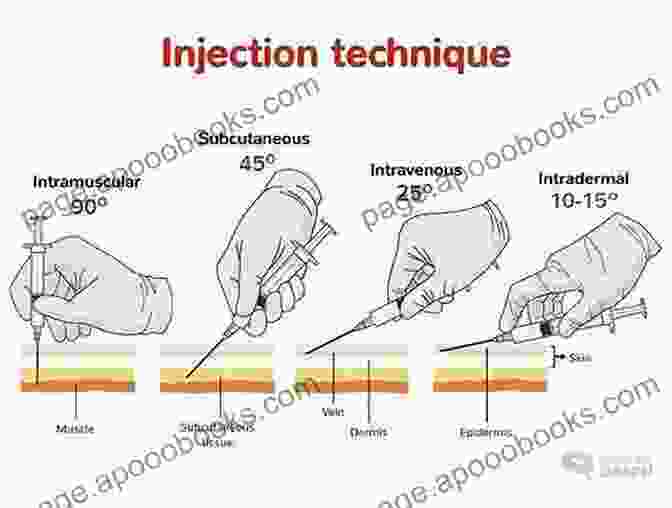 Step By Step Illustrations Demonstrating Proper Injection Techniques Illustrated Manual Of Injectable Fillers (Series In Cosmetic And Laser Therapy)