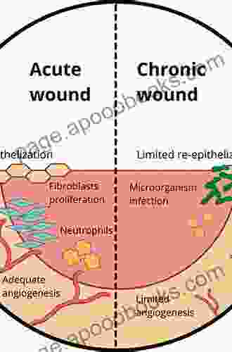 Chronic Wounds Wound Dressings And Wound Healing (Recent Clinical Techniques Results And Research In Wounds 6)