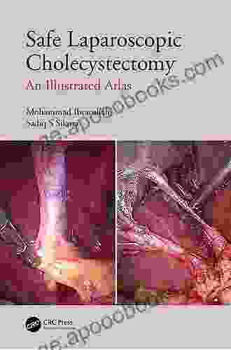 Safe Laparoscopic Cholecystectomy: An Illustrated Atlas