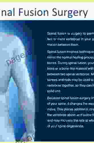 Surgical Approaches To The Spine