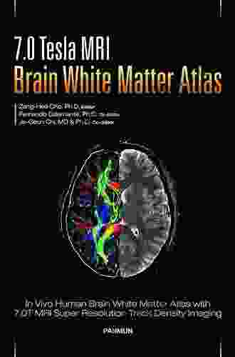 7 0 Tesla MRI Brain White Matter Atlas